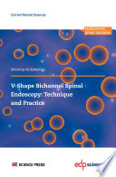 V-Shape Bichannel Spinal Endoscopy : Technique and Practice